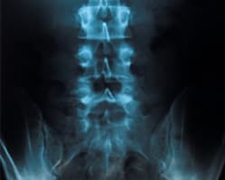 Slider image (6) Dr. GIAN PAOLO TASSI | Neurosurgery Specialist